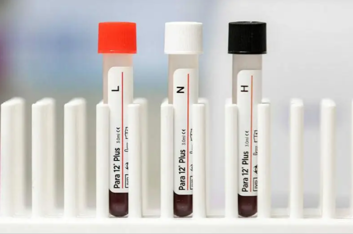 Матеріал контролю гематологічний атестований багато параметричний Para 12 Pius: 3 х 3.0 мл (1 Низький, Норма, Високий)